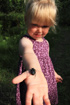 Young girl holding the rare beetle Variable Chafer