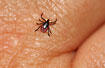 Tick on hand looking for at place to bite